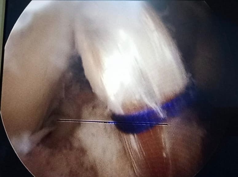 Surgery Image