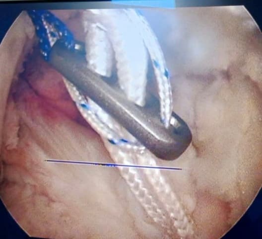 Surgery Image