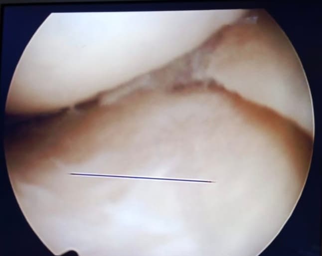 Surgery Image