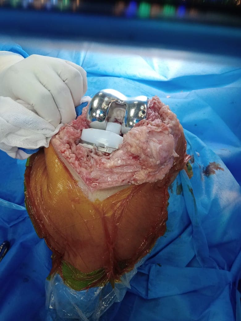 Surgery Image