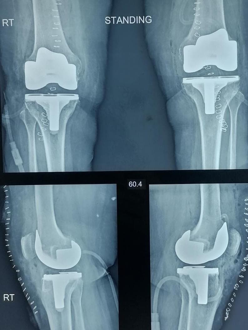 Xray Image