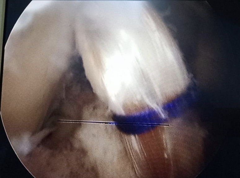 Surgery Image