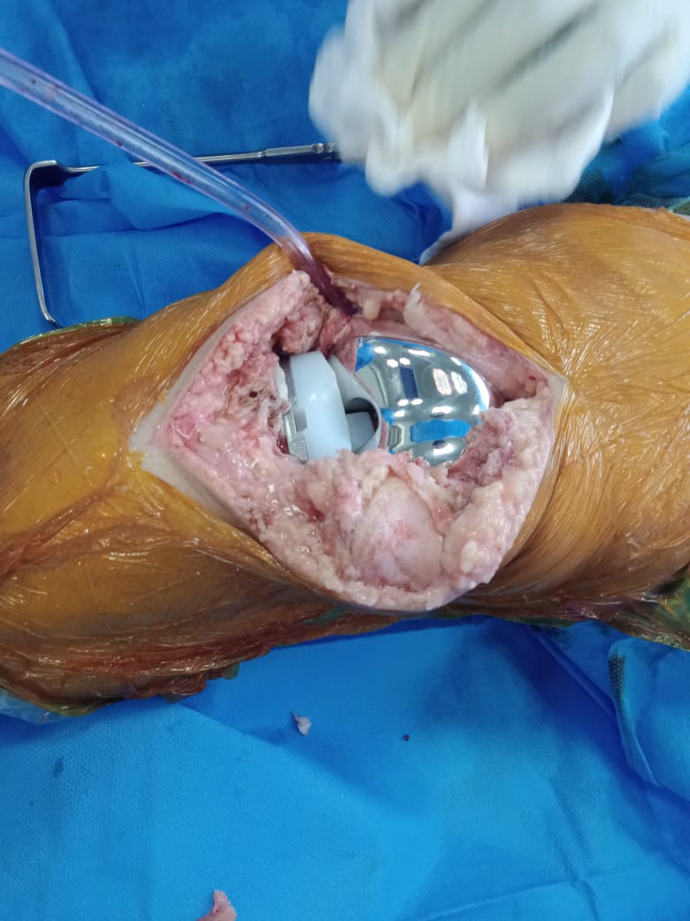 Surgery Image